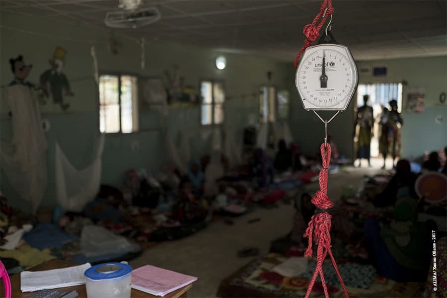 N’Djamena: Besoin urgent d’augmenter la capacité de prise en charge des enfants sévèrement malnutris