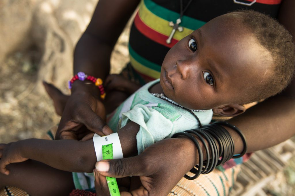 ALIMA Burkina Faso Malnutrition aigue 2017 Copyright ALIMA Photos 19