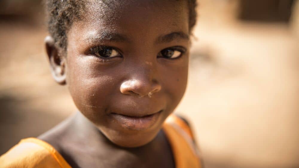 ALIMA Burkina Faso Malnutrition aigue 2017 Copyright ALIMA Photos 38