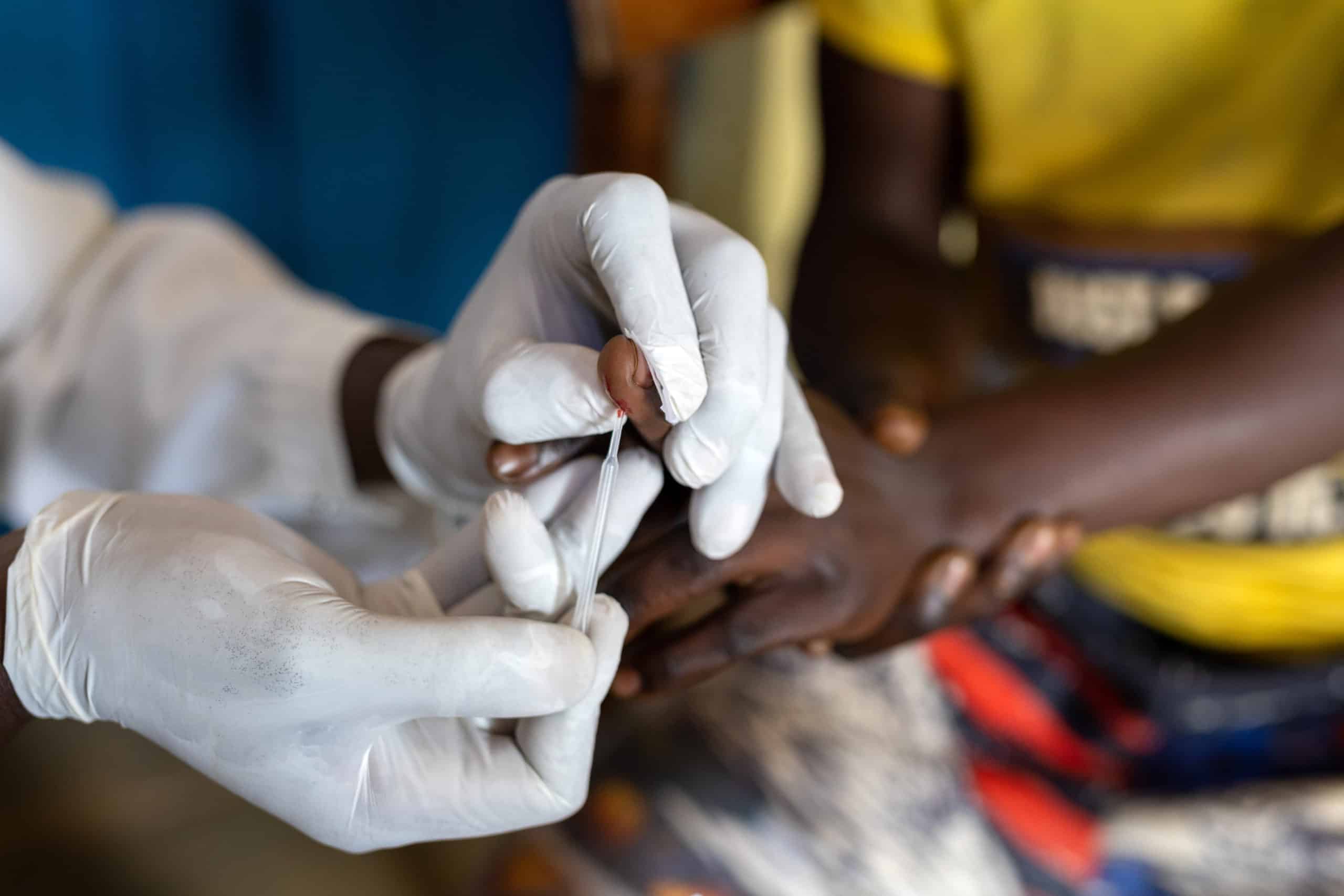 Vaccin RTSS contre le paludisme au Cameroun