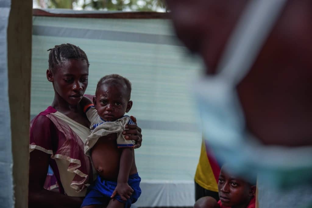 Mpox : les 10 questions clés pour comprendre l'épidémie 1 Mpox Bébé Malade RDC