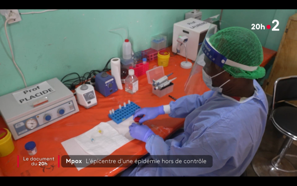 Laboratoire Mpox ALIMA France 2